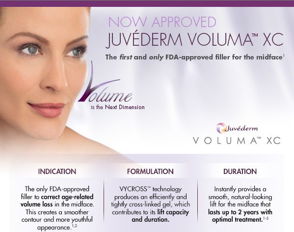 juvederm-voluma-xc